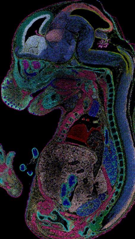 2024中关村论坛发布重大成果华大开云网址时空组学技术Stereo-seq入选(图2)